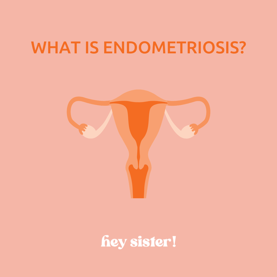 Endometriosis: It's NOT Just Bad Periods – Let's Talk About It (Because We Deserve Better)