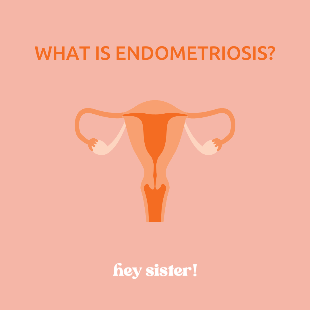 Endometriosis: It's NOT Just Bad Periods – Let's Talk About It (Because We Deserve Better) - Hey Sister!